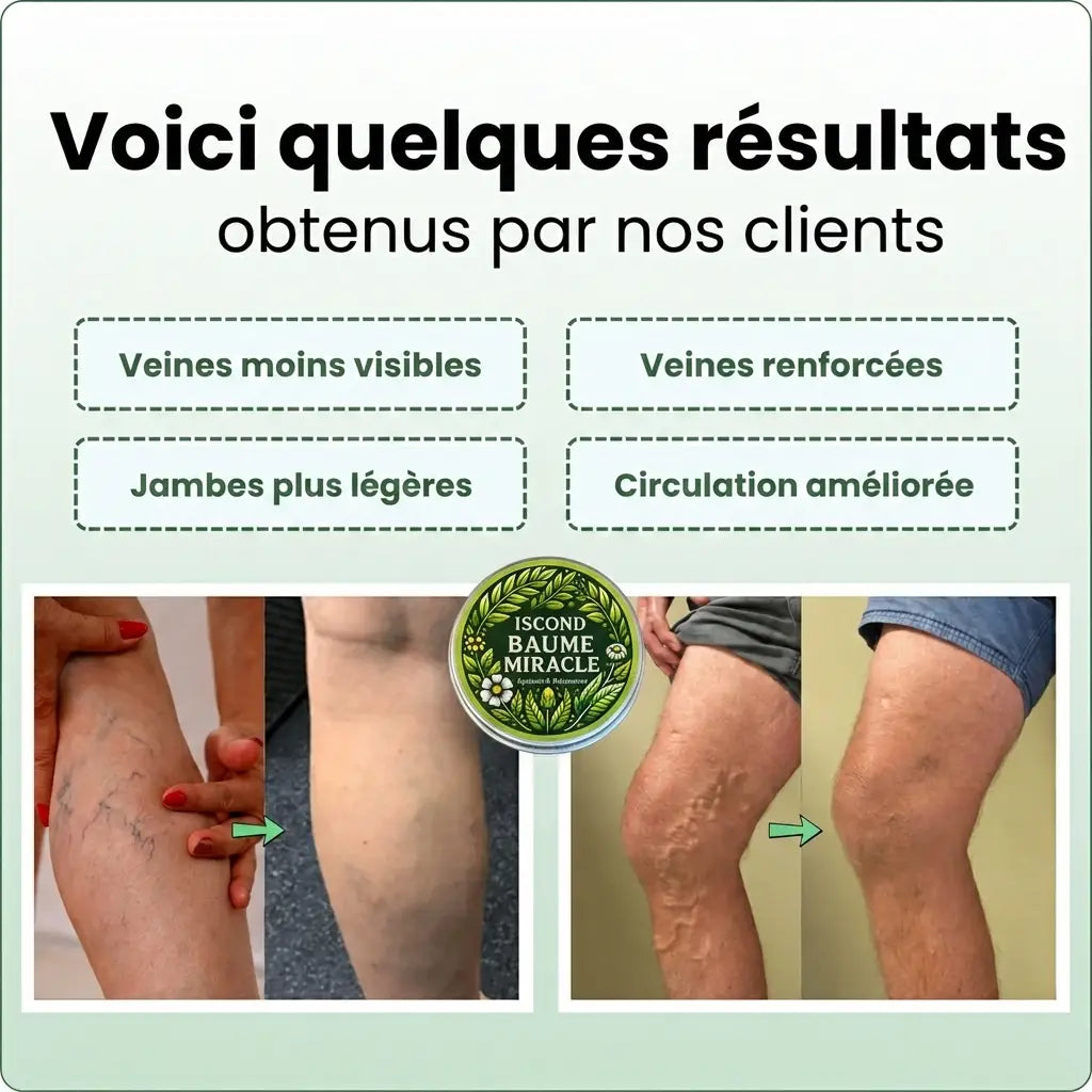 Jambes Lourdes · Muscles Tendus ? Ce Baume Est Fait Pour Vous.